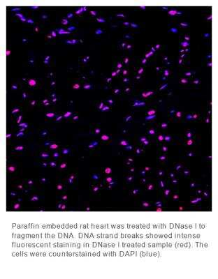 Fluorescence Imaging: OneStep TUNEL Apoptosis Kit [Red, 555] [NBP3-12093]